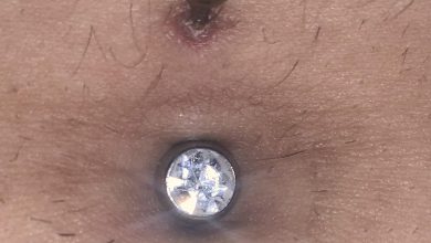 Belly Button Piercing Red around Top Hole