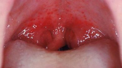 Red Spots at Top of Mouth