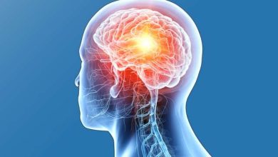 Top 10 Brain Tumor Treatment Centers in the World